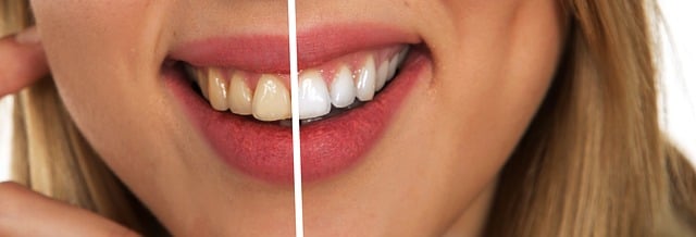 Dentist Maumee Ohio,Dentist,General dentistry 