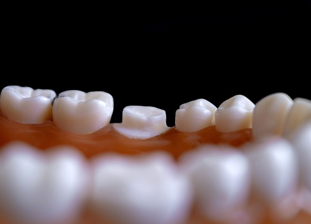 Dentist Northwood Ohio,Dentist,Restorative Dental Services